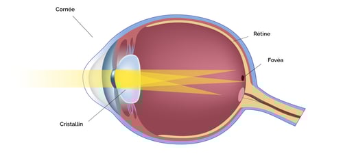 schemaOeilAstigmate2